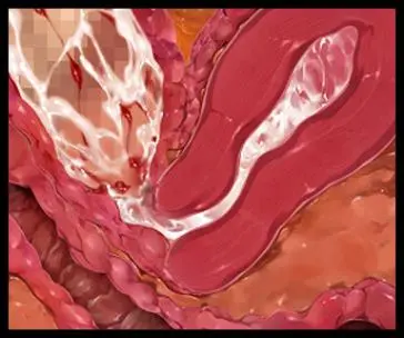 웹툰 이미지 342