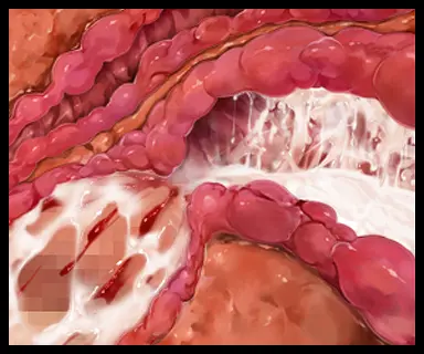 웹툰 이미지 170