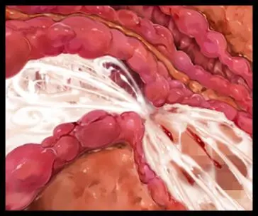 웹툰 이미지 335