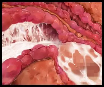 웹툰 이미지 288