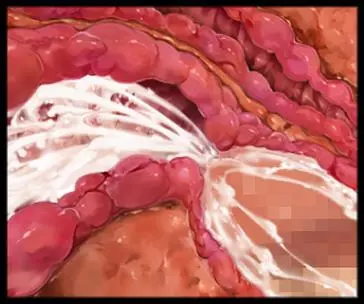 웹툰 이미지 287
