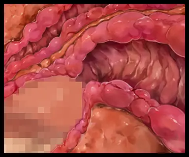 웹툰 이미지 123