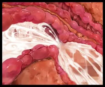 웹툰 이미지 289
