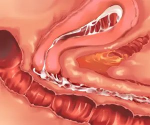 웹툰 이미지 181