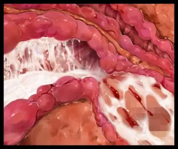 웹툰 이미지 334