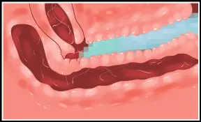 웹툰 이미지 31