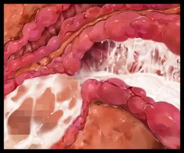 웹툰 이미지 305
