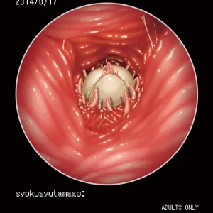 Syokusyu Tamago