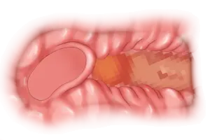 웹툰 이미지 104