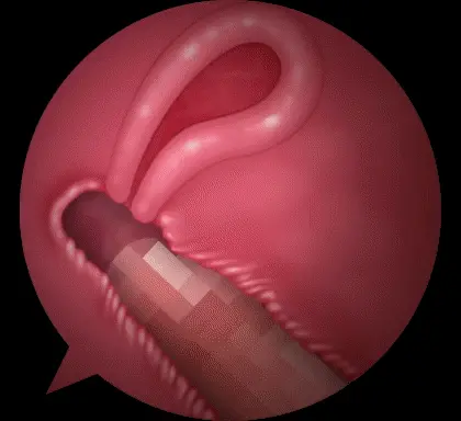 웹툰 이미지 44