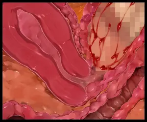 웹툰 이미지 237