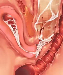 웹툰 이미지 159