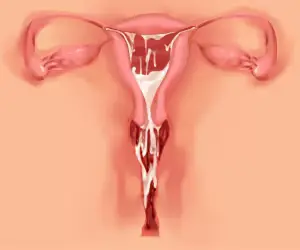 웹툰 이미지 88