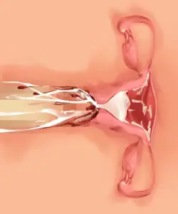 웹툰 이미지 168