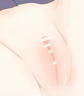 웹툰 이미지 82