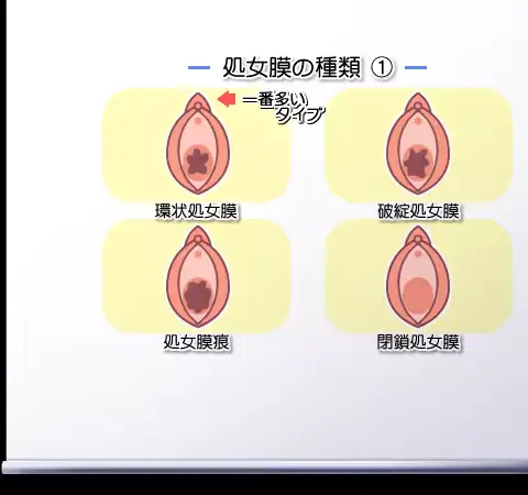 웹툰 이미지 443