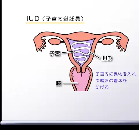 웹툰 이미지 388