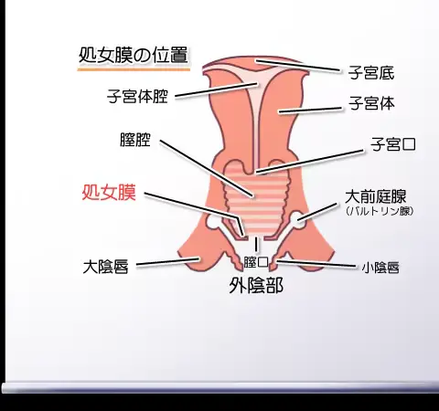 웹툰 이미지 442